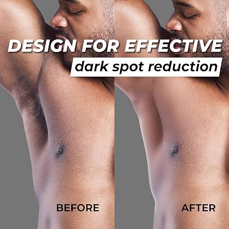 Abera Armpit Roller with Betel Leaf