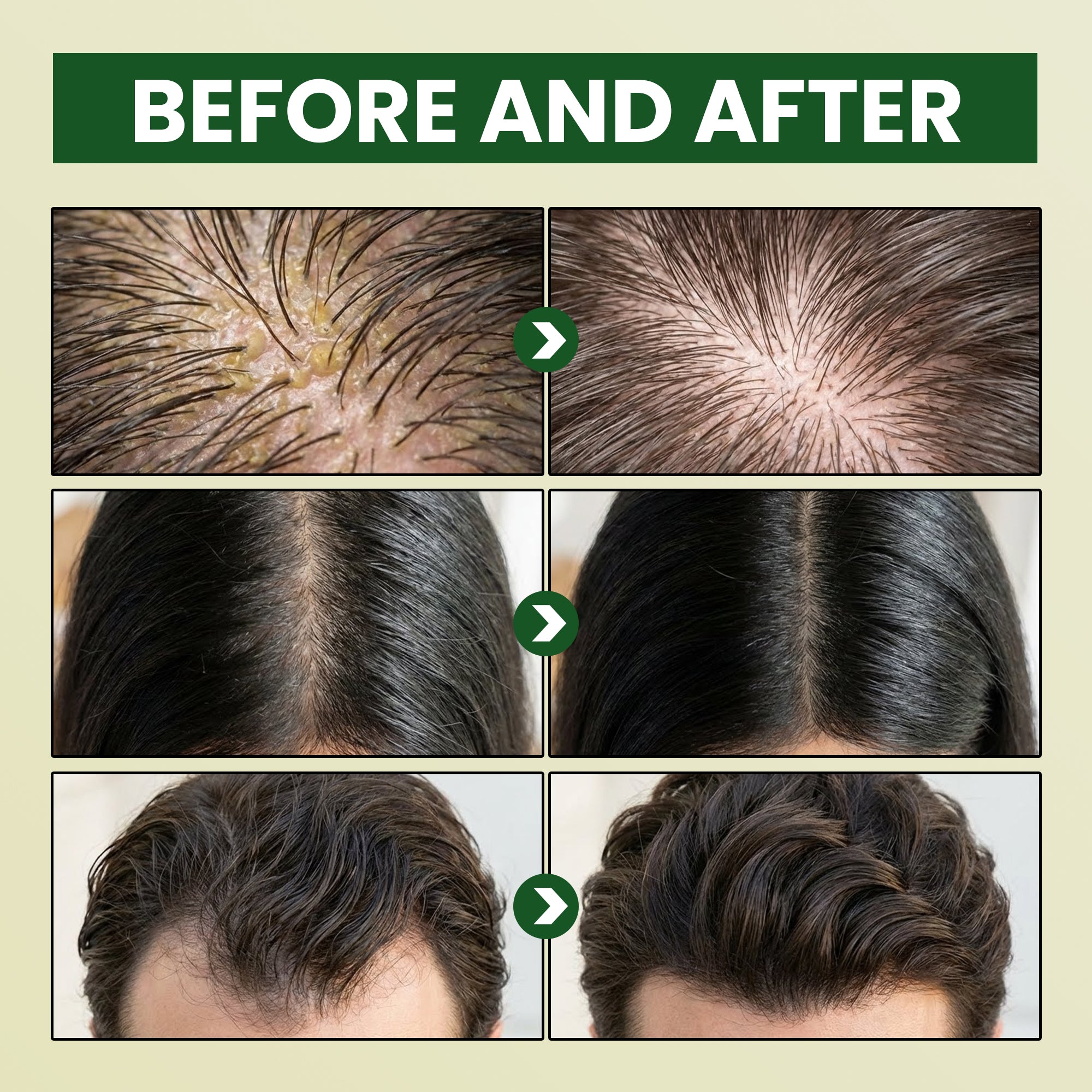 ABERA Hair Regrowth Shampoo With Grapefruit Essence