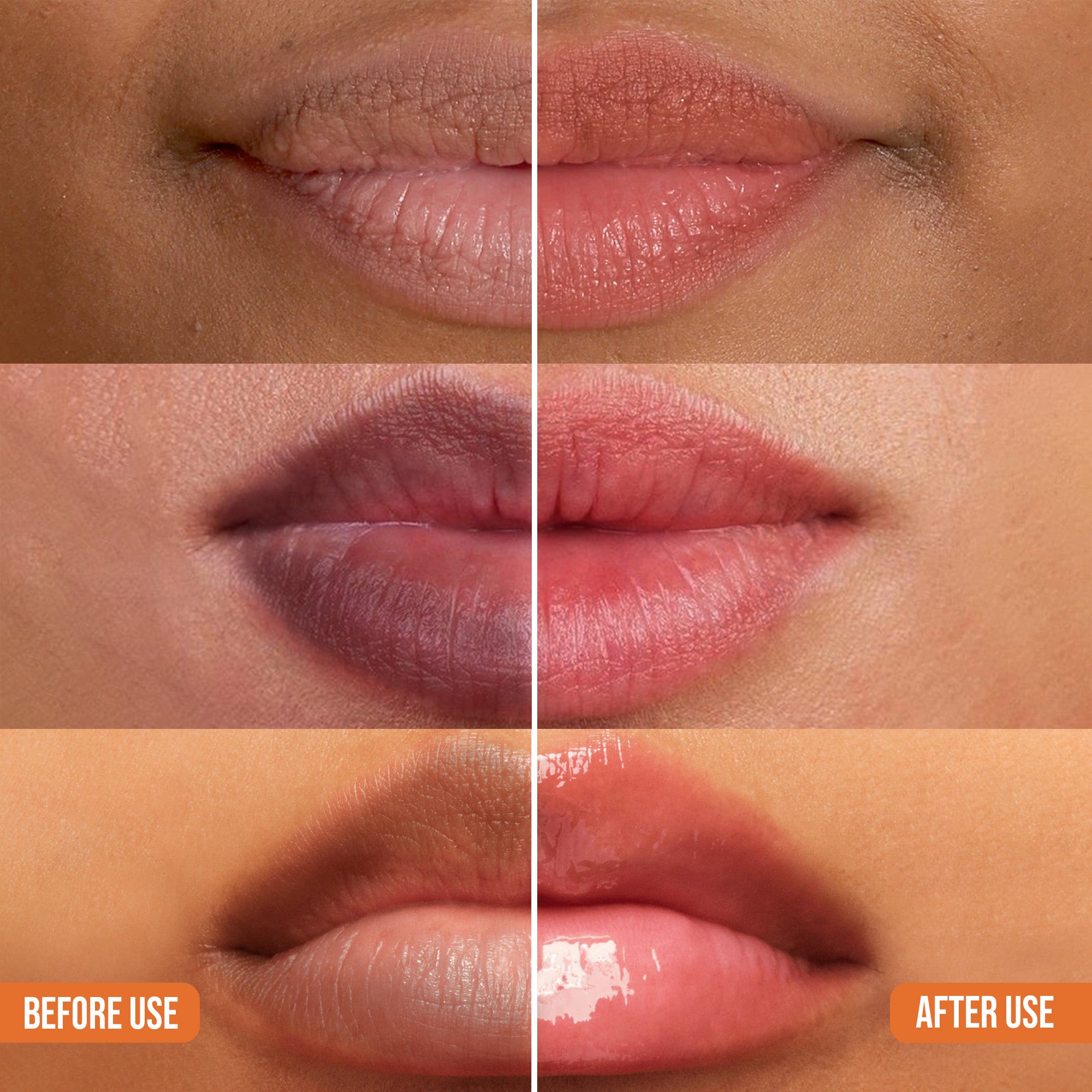 Abera Dark Lip Corrector Cream For Men & Women