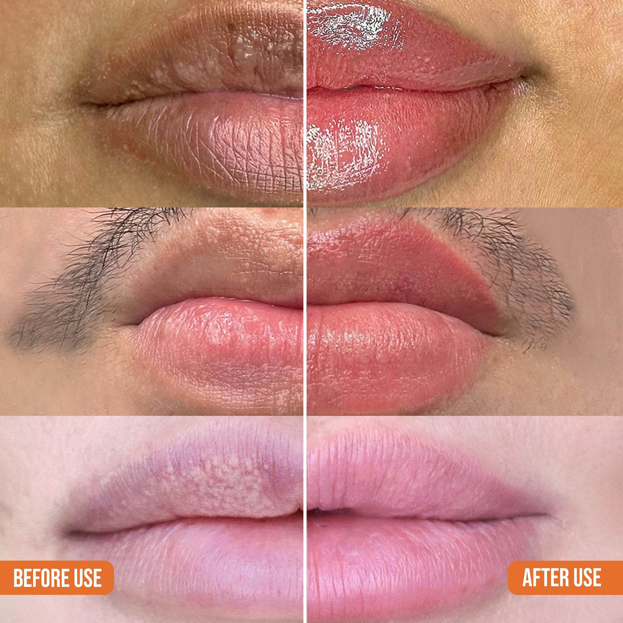 Abera Dark Lip Corrector Cream For Men & Women